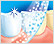 Blanqueamiento